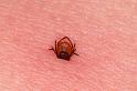 Ixodes_ricinus_D5038_Z_90_Les Gris_Frankrijk